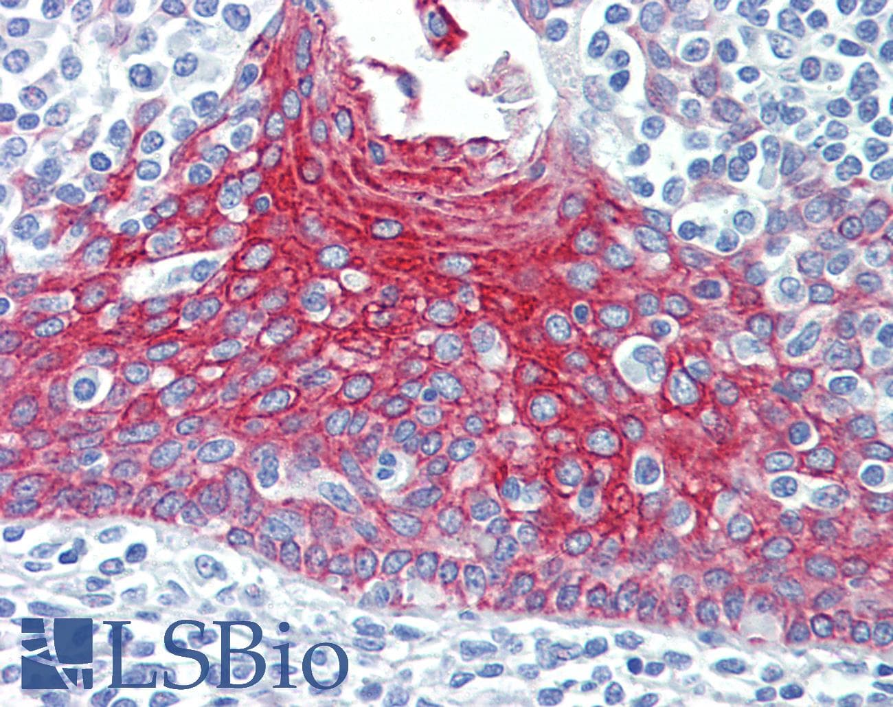 IHC-plus™ KRT7 / CK7 / Cytokeratin 7 Antibody (clone 5D12)