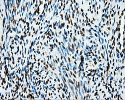 Monoclonal Mouse anti-Human APP / Beta Amyloid Precursor Antibody (clone OTI9E2, IHC, IF, WB)
