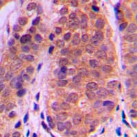 HDAC5 Antibody (C-Terminus)