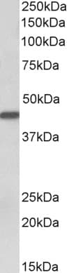 PathPlus™ Polyclonal Goat anti-Human KRT19 / CK19 / Cytokeratin 19 Antibody (aa385-398, IHC, WB)