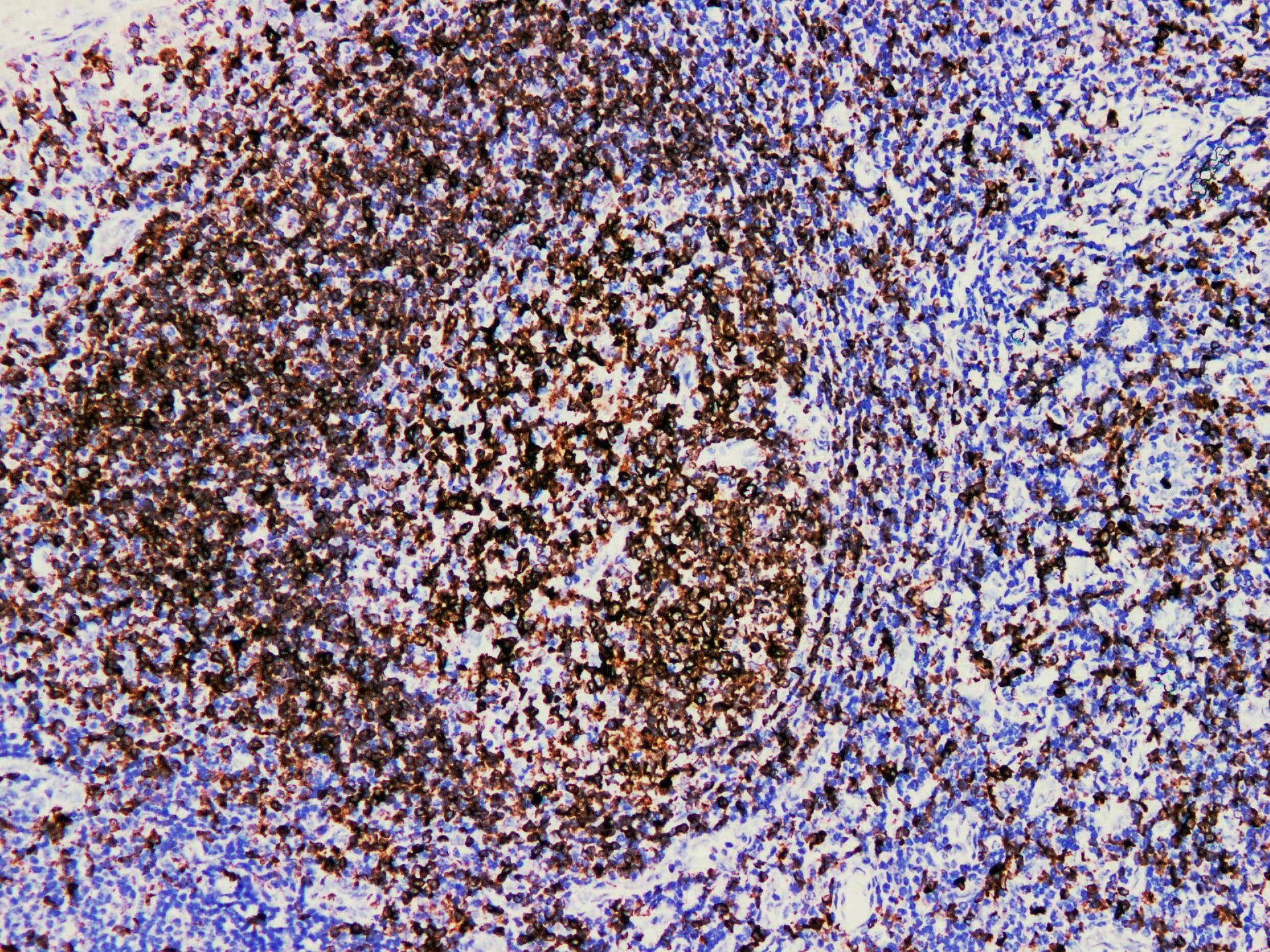 CD74 / CLIP Antibody