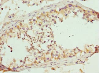 RASGRF1 / CDC25 Antibody