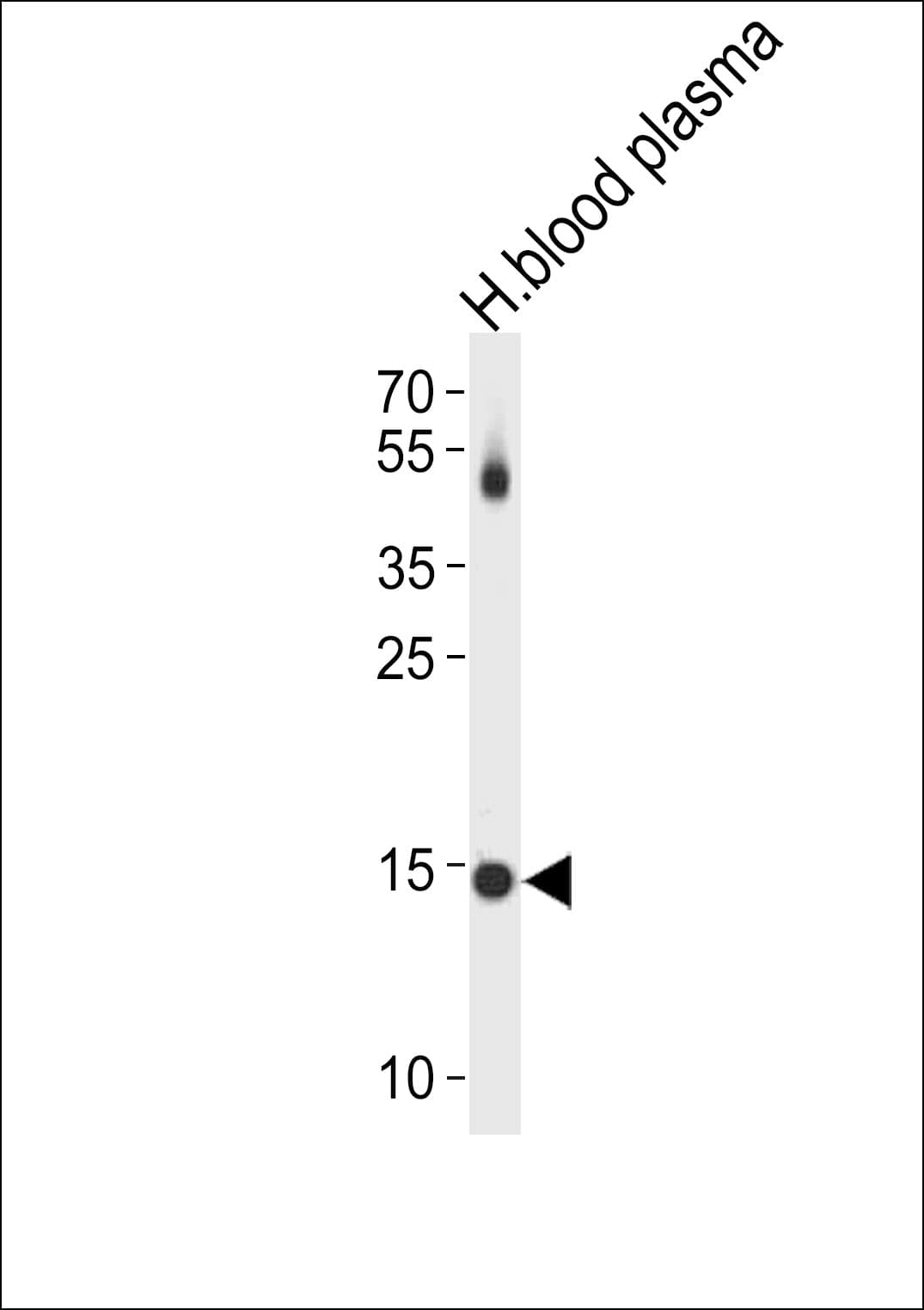 TTR / Transthyretin Antibody (aa71-98)