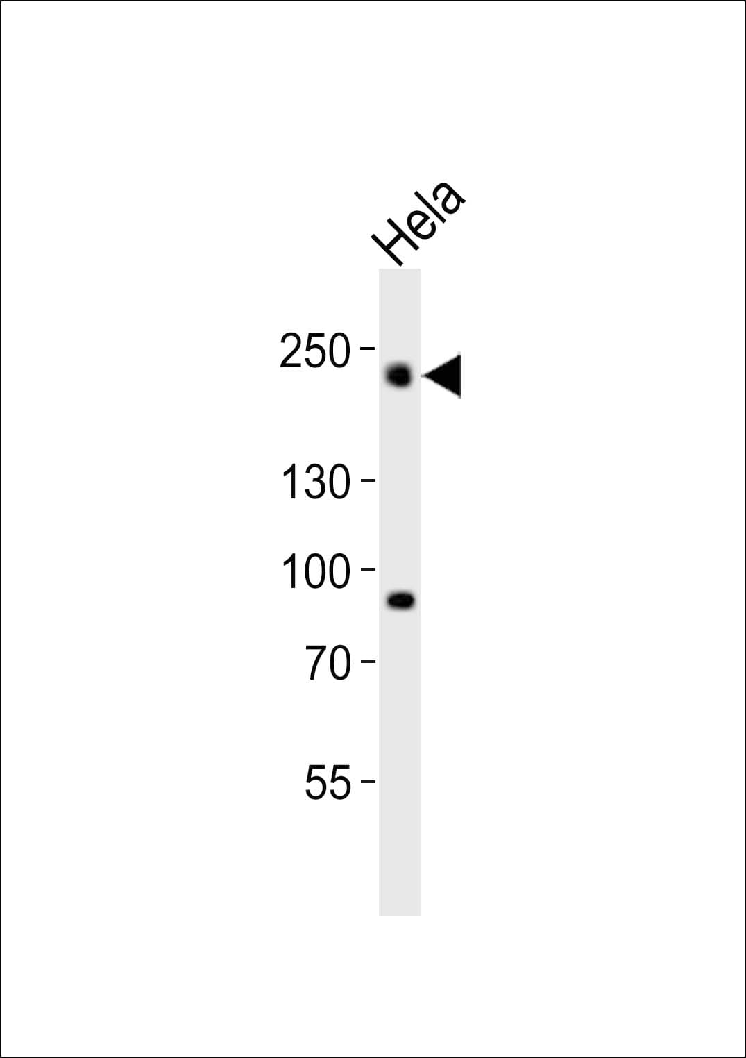 Polyclonal Rabbit anti-Human DNMT / DNMT1 Antibody (aa363-396, WB)
