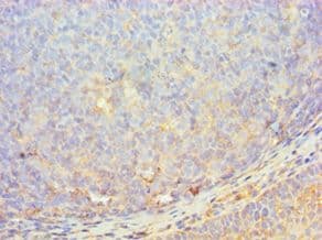 IHC-plus™ MER / MERTK Antibody (aa840-999)