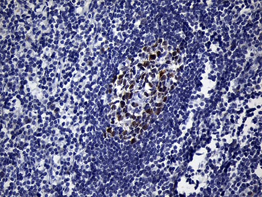 Monoclonal Mouse anti-Human BCL6 Antibody (clone OTI8A3, aa1-300, IHC)