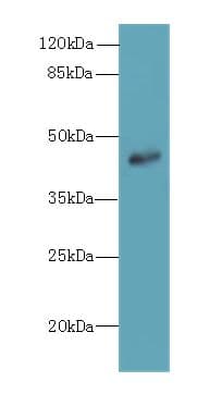 Polyclonal Rabbit anti-Human ZNF670 Antibody (IHC, WB)