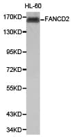 Polyclonal Rabbit anti-Human FANCD2 Antibody (IHC, WB)