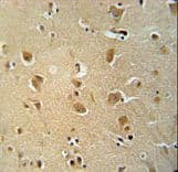 WWC3 Antibody (aa1008-1037)