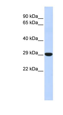 Polyclonal Rabbit anti-Human HOXB8 Antibody (N-Terminus, WB)