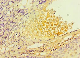 Polyclonal Rabbit anti-Human TERF2IP / RAP1 Antibody (aa1-280, IHC)