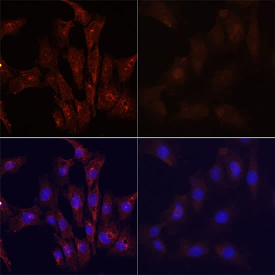 Polyclonal Rabbit anti-Human MAP1LC3B / LC3B Antibody (IHC, IF, WB)