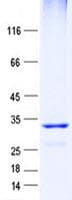 Human ECI1 / DCI Protein (Recombinant His, N-Terminal)