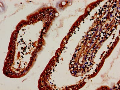 Polyclonal Rabbit anti-Human DNASE2 / DNase II Antibody