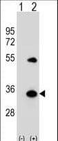 IHC-plus™ Polyclonal Rabbit anti-Human APG5 / ATG5 Antibody (aa1-30, IHC, IF, WB)
