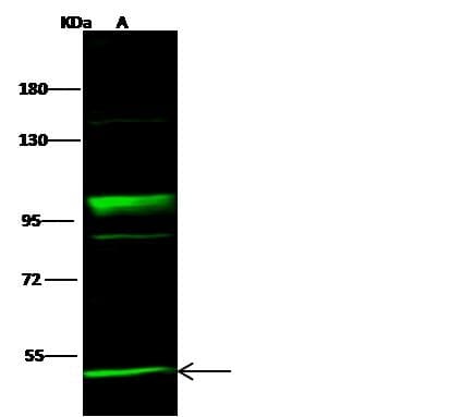 Polyclonal Rabbit anti-Human NEK10 Antibody (Preservative Free, WB)