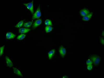SEMA6B / Semaphorin 6B Antibody