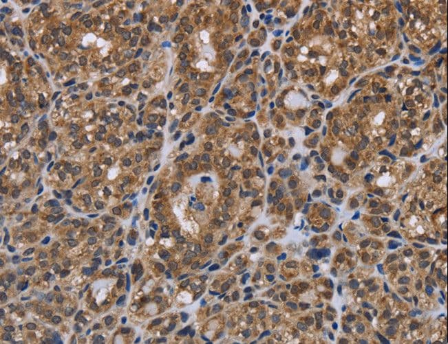 Polyclonal Rabbit anti-Human GALK1 / GK1 Antibody (IHC, WB)