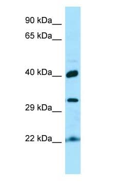 KTI12 Antibody (aa180-229)