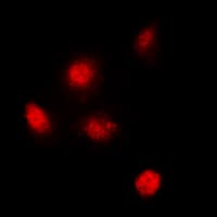 Polyclonal Rabbit anti-Human SPT3 / SUPT3H Antibody (Internal, IHC, IF, WB)