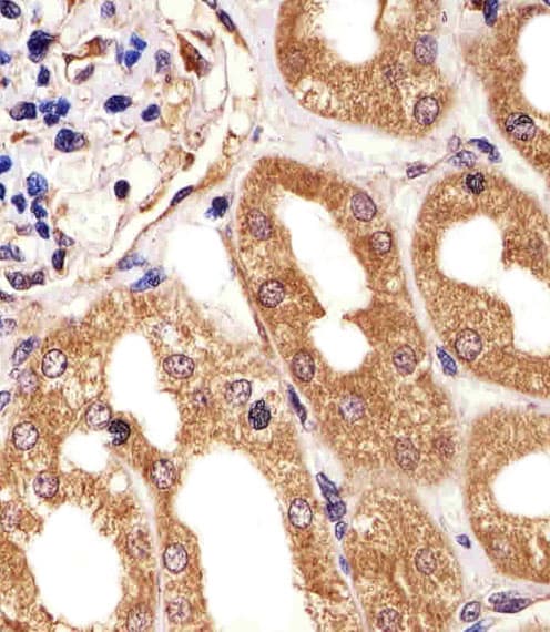 PARK7 / DJ-1 Antibody (aa130-164)