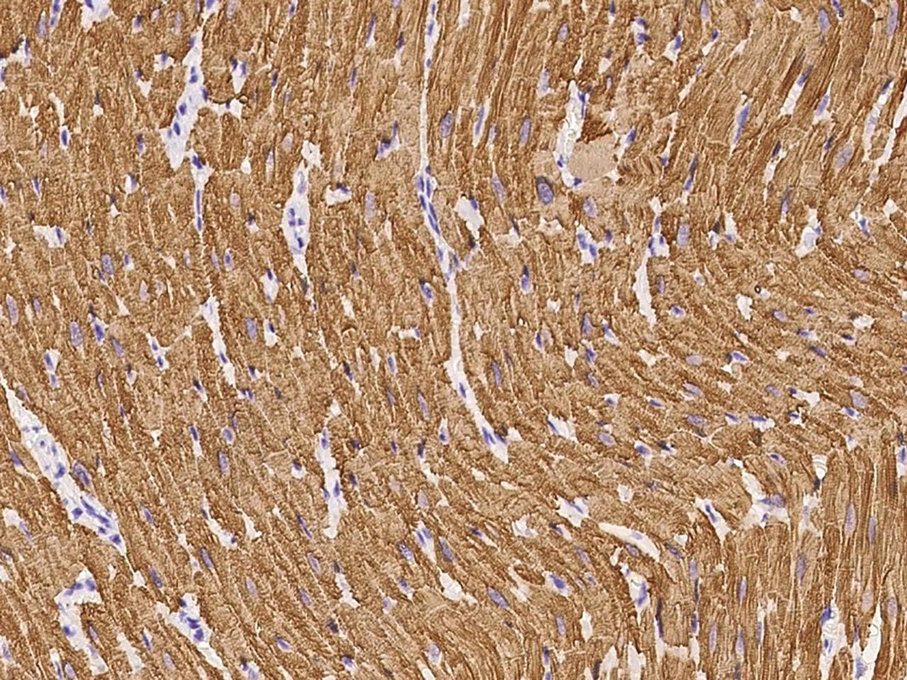 TNNC1 / Cardiac Troponin C Antibody (Preservative Free)