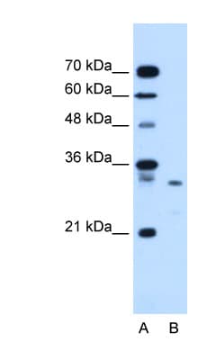 Polyclonal Rabbit anti-Human SDCBP / Syntenin Antibody (aa101-150, IHC, WB)