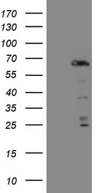 FOXO4 / AFX1 Antibody (aa206-505, clone OTI10F12)
