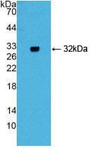 GIF / Intrinsic Factor Antibody (aa31-288)