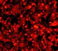 Monoclonal Rabbit anti-Human GAB2 Antibody (clone EP369Y, Internal, WB)