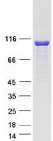 Human CYLD Protein (Recombinant Myc-DDK (Flag))
