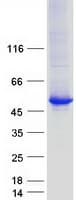 Human TTC38 Protein (Recombinant Myc-DDK (Flag))