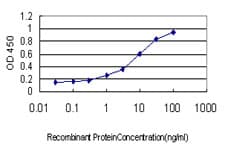 ETV6 / TEL Antibody (clone 3B10)