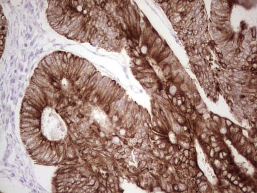 ABCB1 / MDR1 / P Glycoprotein Antibody (aa995-1280, clone OTI8A9)