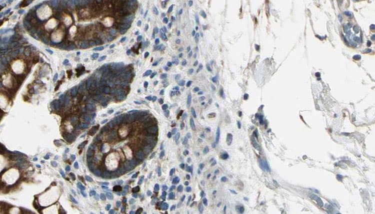 CXCR2 Antibody (phospho-Ser347)