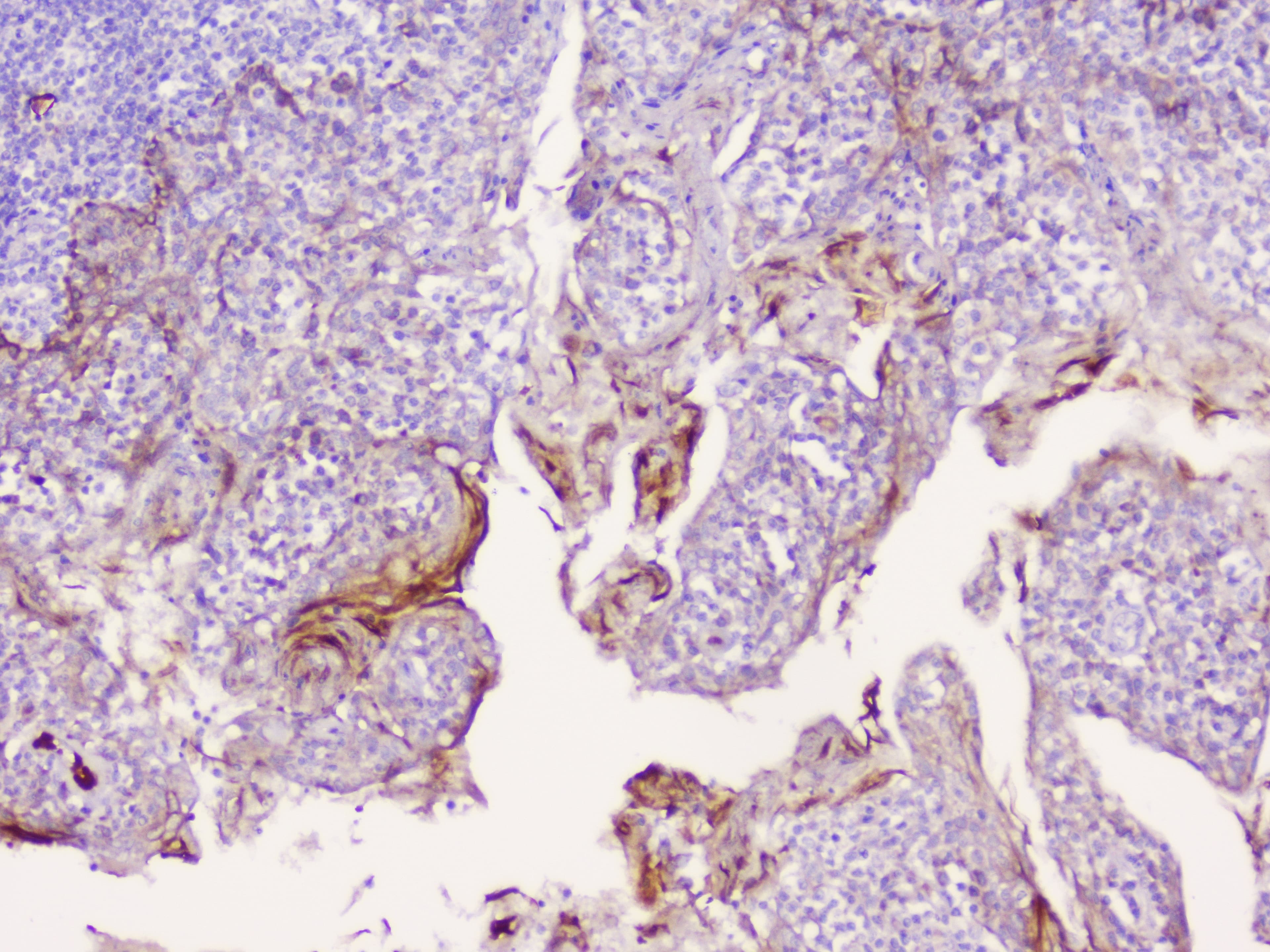 CD1B Antibody