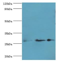 GSTO2 Antibody (aa124-243)