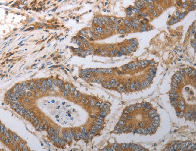 Polyclonal Rabbit anti-Human SLC22A6 / OAT1 Antibody (IHC, WB)