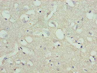 STOX1 Antibody