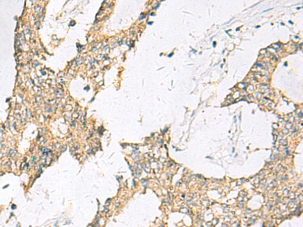 SPACA1 Antibody