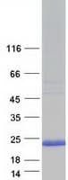 Human TMEM230 Protein (Recombinant Myc-DDK (Flag))