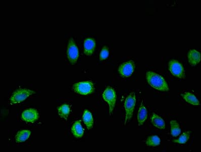 ATP6V1C2 Antibody