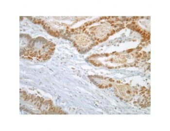 Monoclonal Mouse anti-Human MAD2L1 / MAD2 Antibody (clone 17D10, IHC, WB)