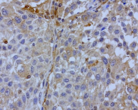 Monoclonal Mouse anti-Human BID Antibody (clone UMAB139, Carrier-free, IHC, WB)