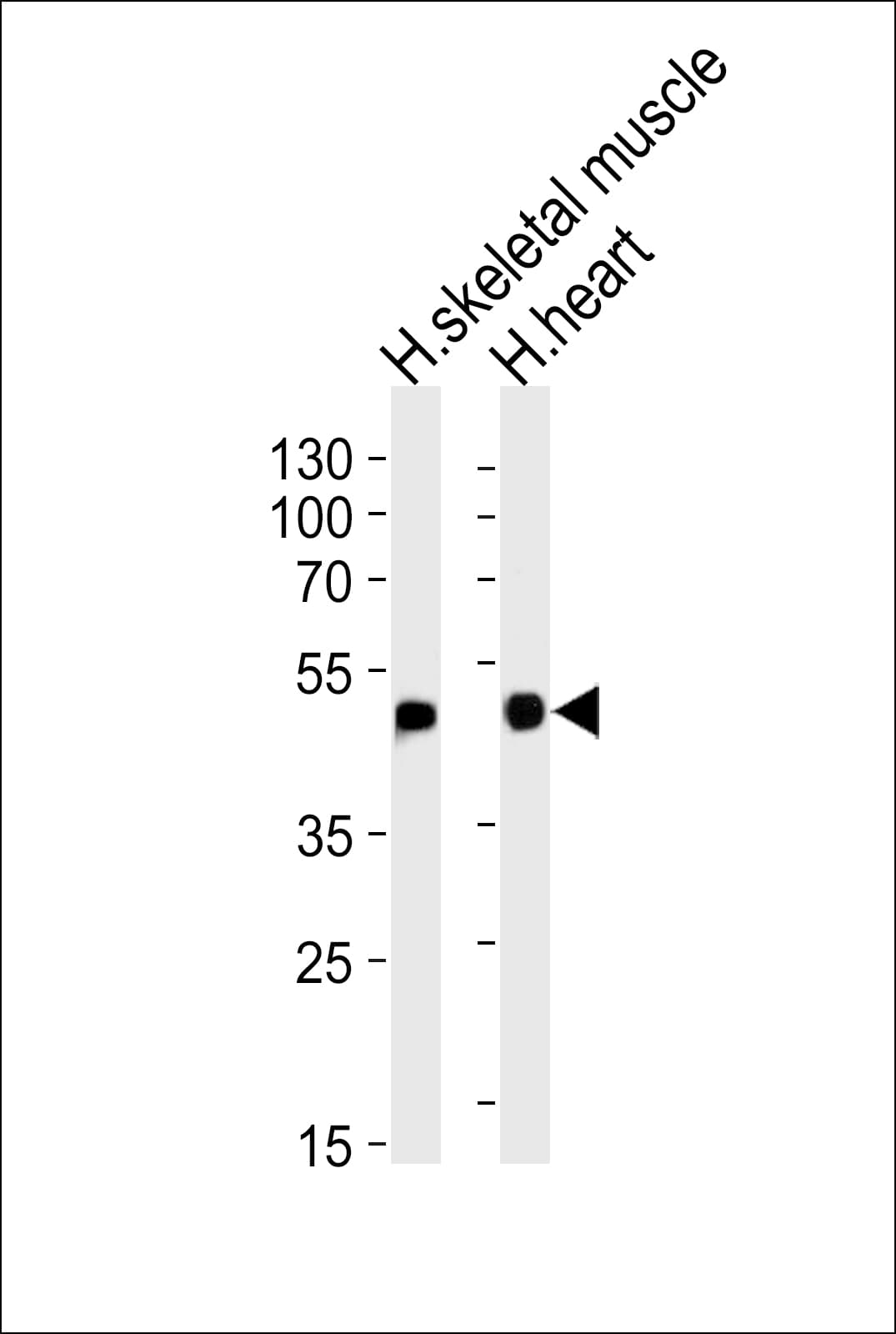 HFE2 / Hemojuvelin Antibody (aa134-162)
