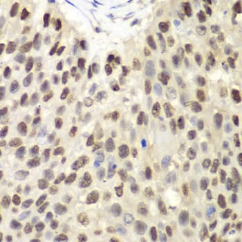 MCM6 Antibody