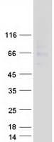 Human ARSG / Arylsulfatase G Protein (Recombinant Myc-DDK (Flag))