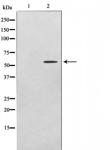 ADCK1 Antibody