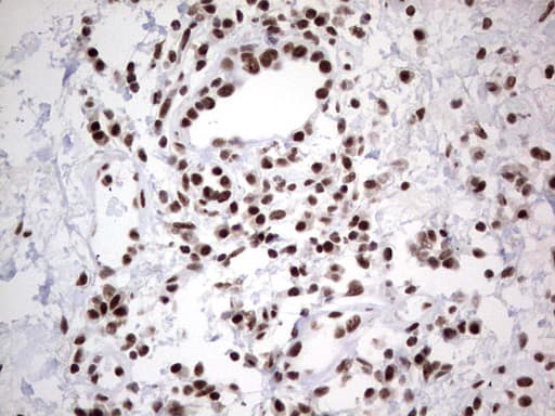 HDAC9 Antibody (aa181-460, clone OTI7G2, Carrier-free)