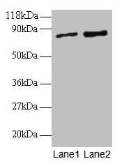Polyclonal Rabbit anti-Human RAB1A Antibody (IHC, WB)